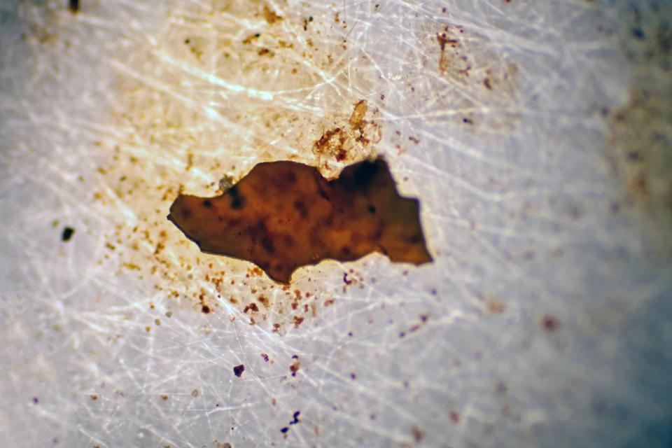 Mikroplastika može ubrzati starenje i uticati na moždane funkcije