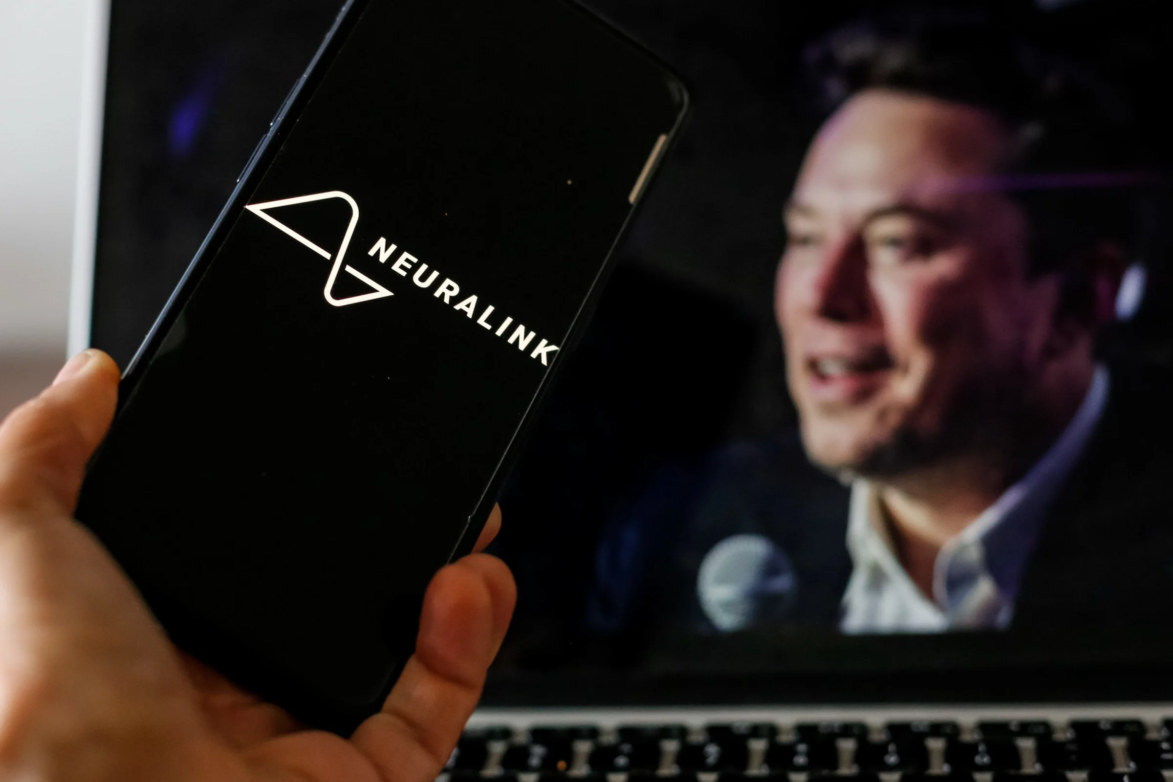 Neuralink ugradio moždani implantat još dvojici pacijenata