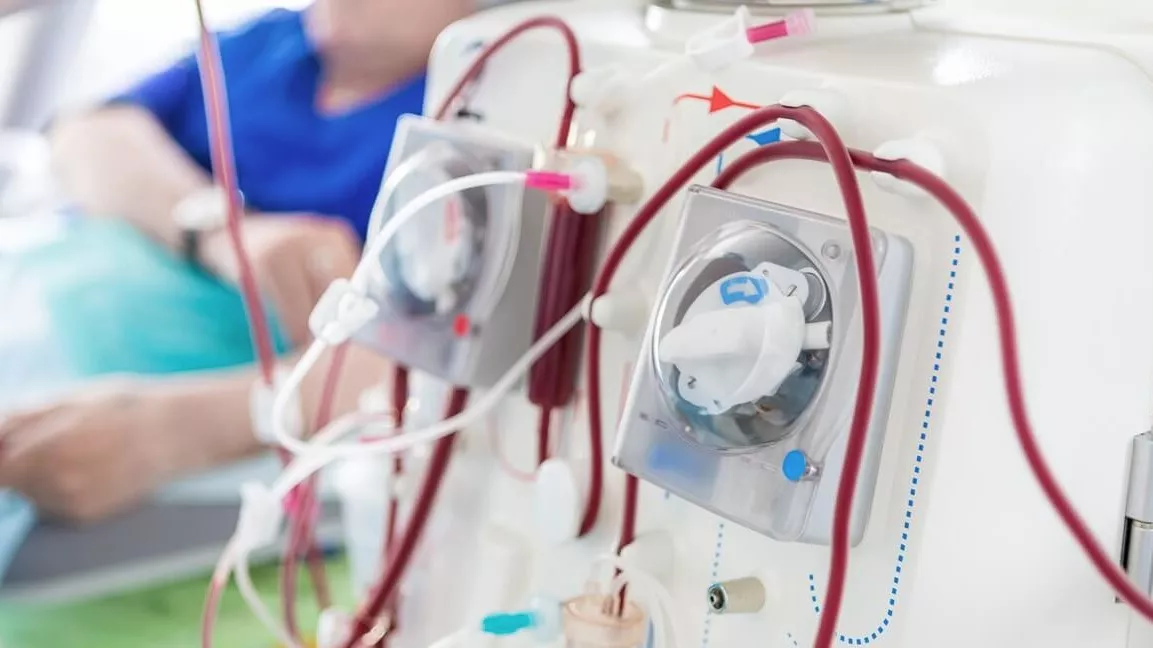 Više od 2.700 pacijenata u BiH na dijalizi; preminulo preko 300 osoba