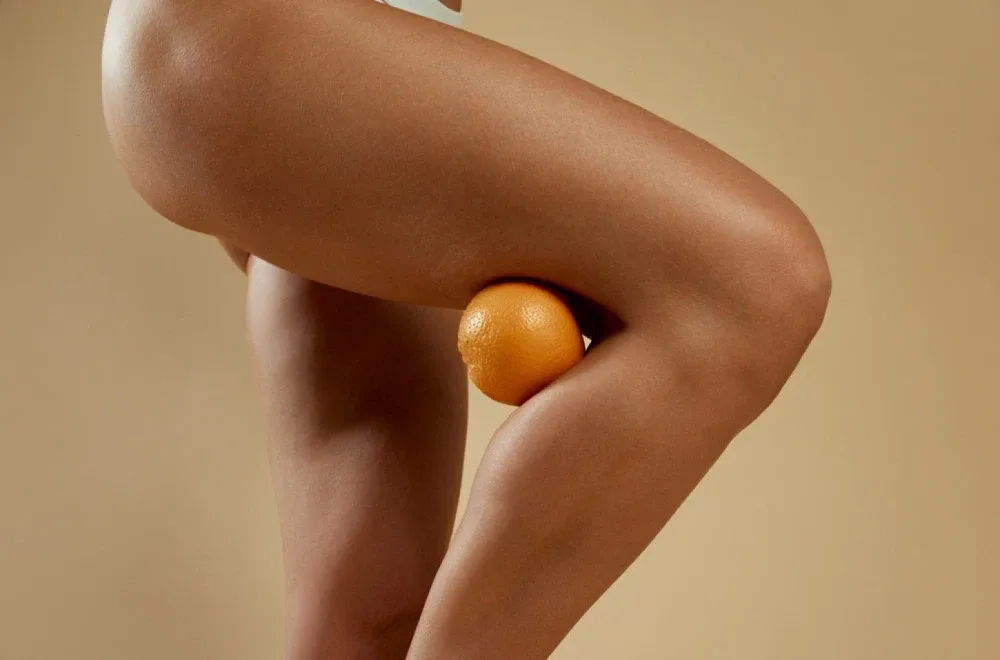 Magična namirnica protiv celulita: Jednostavan tretman za glatku kožu