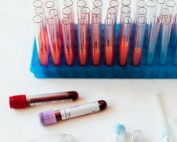 From above of plastic stand with test tubes of blood placed on white surface near vials of blood and syringe