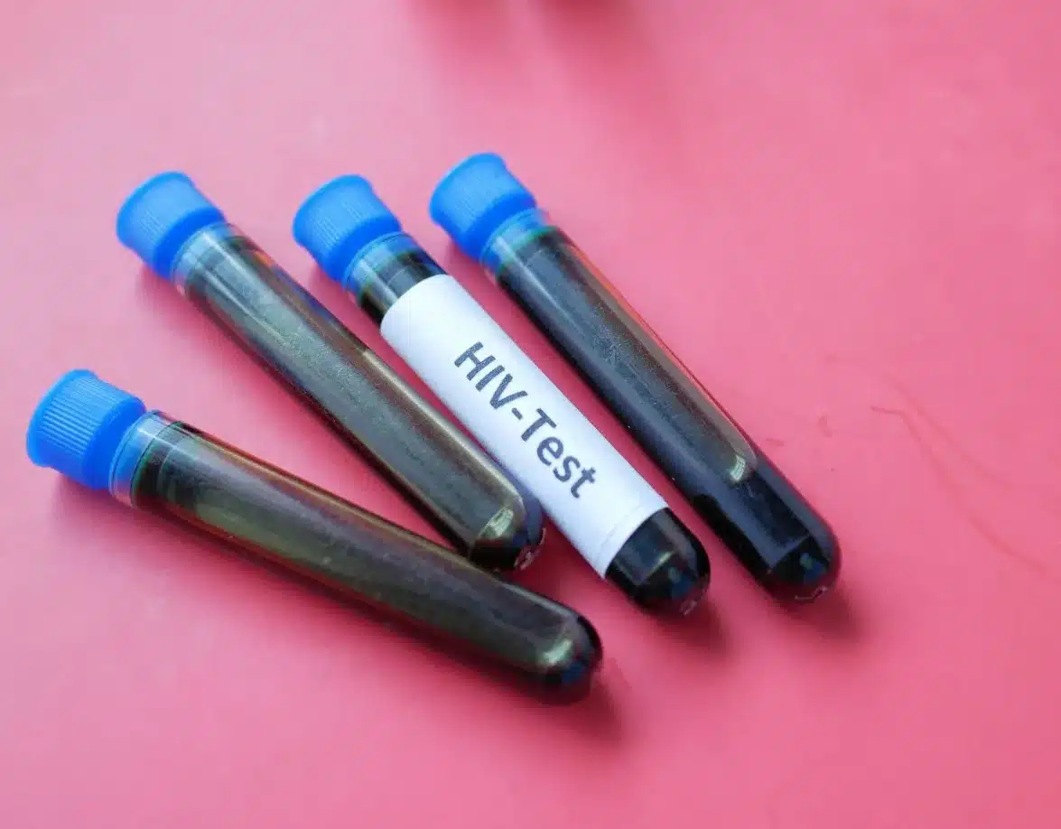 Sutra besplatno i anonimno testiranje na HIV, hepatitis B i C u 13 gradova u BiH Sutra besplatno i anonimno testiranje na HIV, hepatitis B i C u 13 gradova u BiH