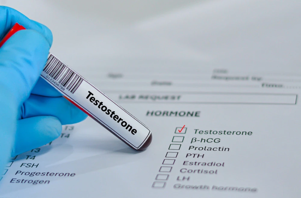 Ljekari upozoravaju: Sve veći broj muškaraca traži nepotrebnu terapiju testosteronom Ljekari upozoravaju: Sve veći broj muškaraca traži nepotrebnu terapiju testosteronom