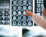 Radiologist pointing at brain MRI scans showing detailed medical examination.