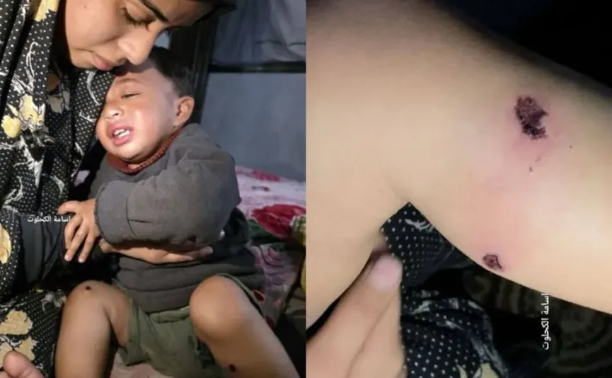 Majka tješi uplakano dijete koje ima vidljive rane i povrede na nogama, što ukazuje na neku vrstu stradanja.