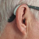 Frankov znak na uhu: Rani znak srčanih bolesti