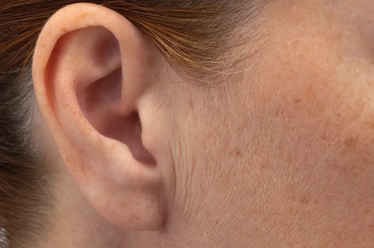 Detaljan prikaz ženskog uha i dijela lica sa pjegama i sitnim dlačicama.