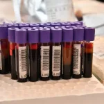 Biološka starost organa: Zašto krv može reći više od datuma rođenja