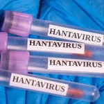 Hantavirus na kruzeru: Pacijenti stabilni, prijeti novi val