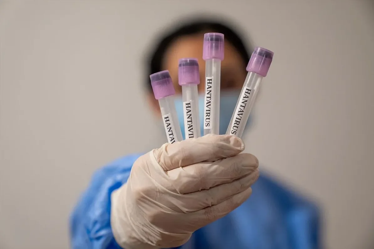 Laboratorijska radnica drži četiri epruvete s natpisom 'Hantavirus'.