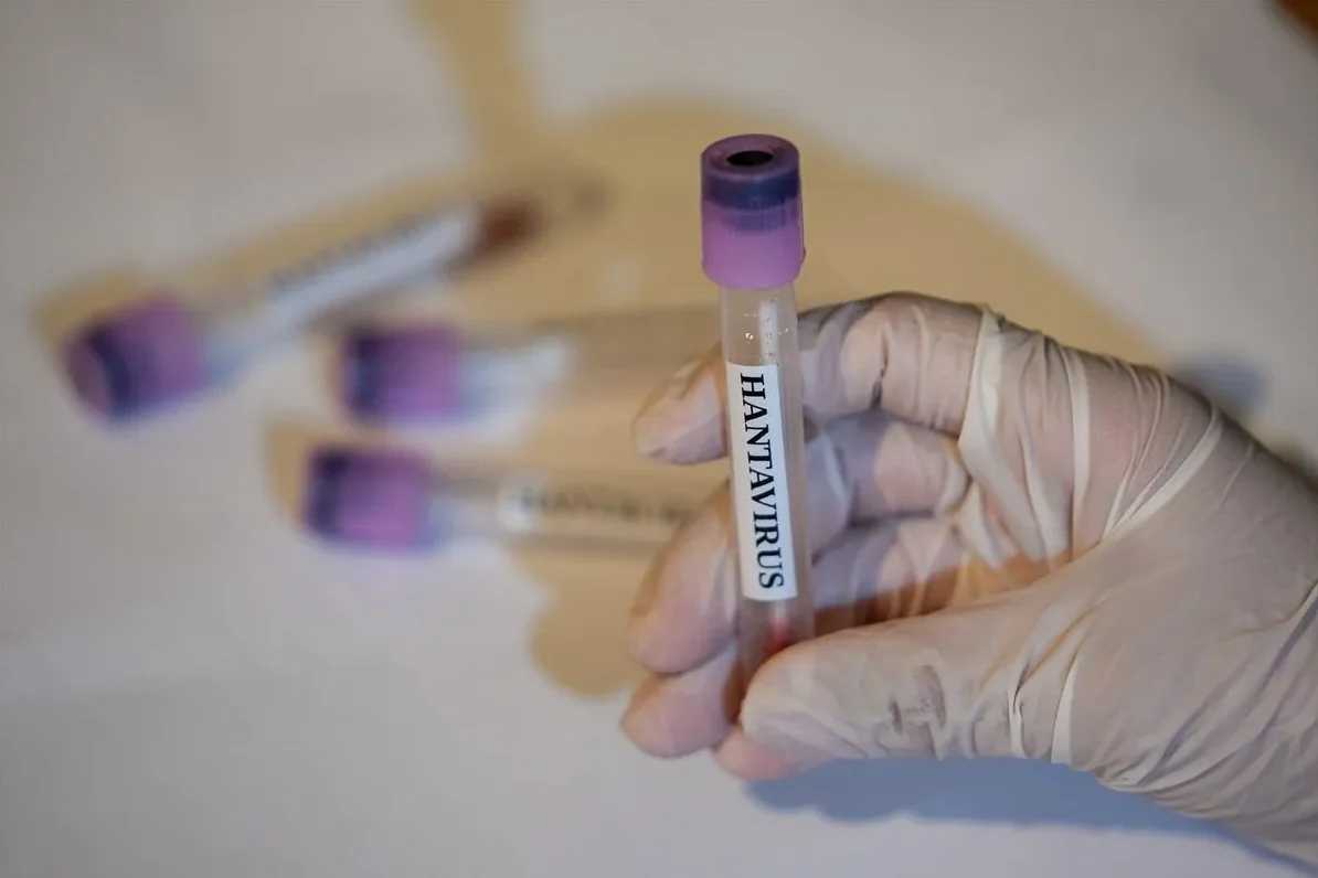 Ruka u rukavici drži epruvetu s oznakom "HANTAVIRUS"