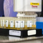 Novi test urina: Može li spriječiti nepotrebno liječenje raka mjehura?