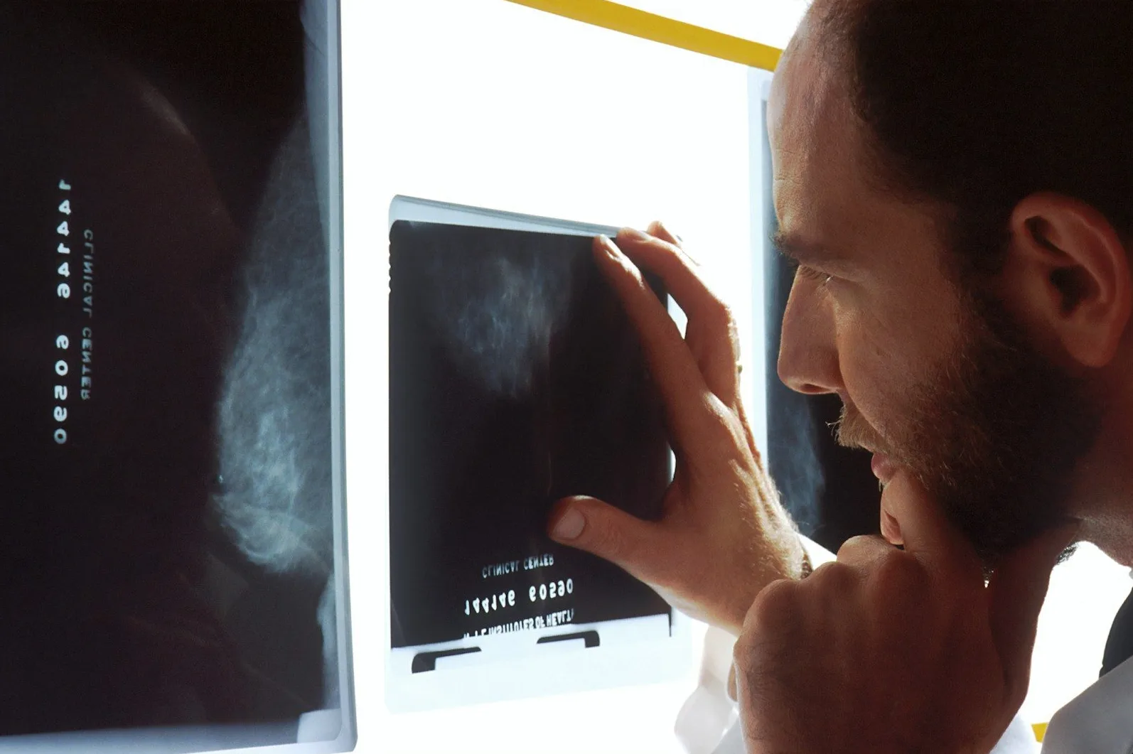 Ljekar u profilu pregleda mamografske snimke na osvijetljenom ekranu.