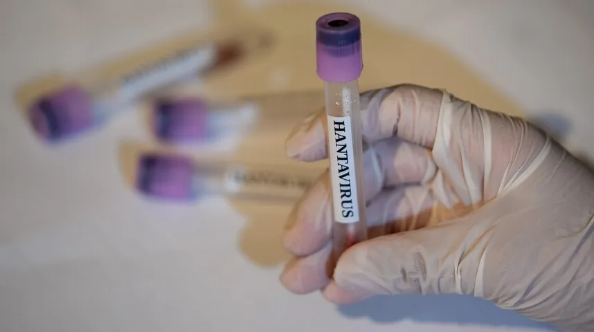Ruka u bijeloj rukavici drži epruvetu za testiranje s natpisom "HANTAVIRUS".