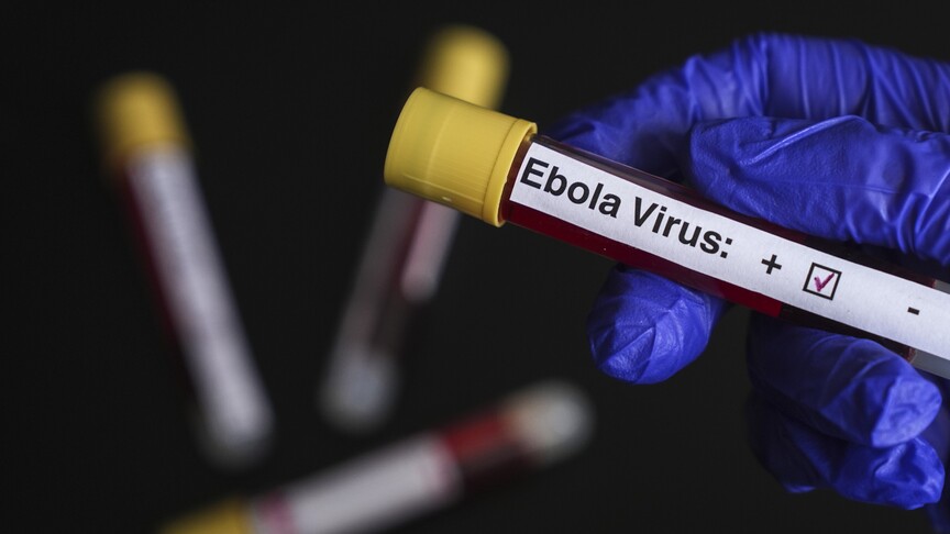 Prvi uvozni slučaj ebole u Francuskoj: Ljekar se vratio iz Konga
