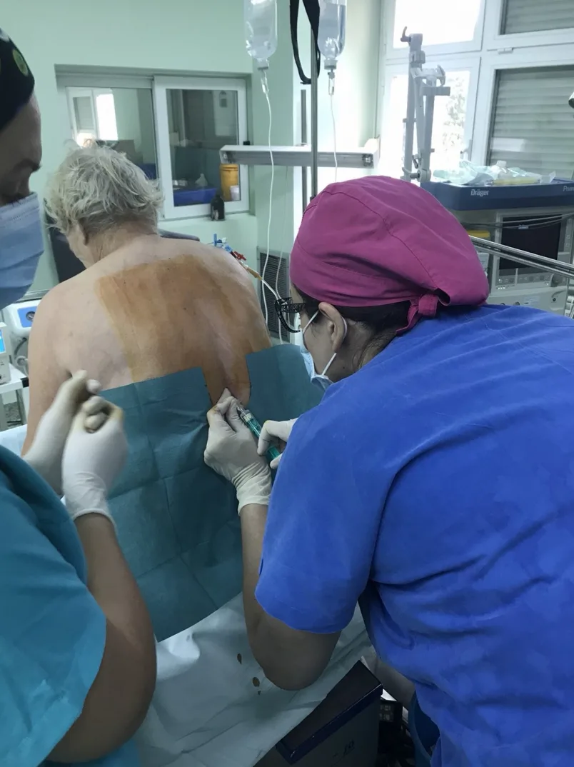 Epiduralna anestezija kod pacijenta