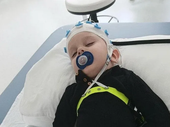 Dijete sa EEG kapom i dudom na usnama leži na medicinskom krevetu.